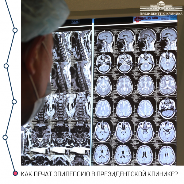 Как лечат эпилепсию в Президентской клинике?