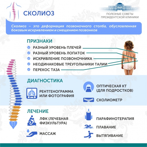 Полезные советы от Президентской клиники. Сколиоз