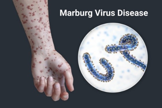 Marburg virus disease