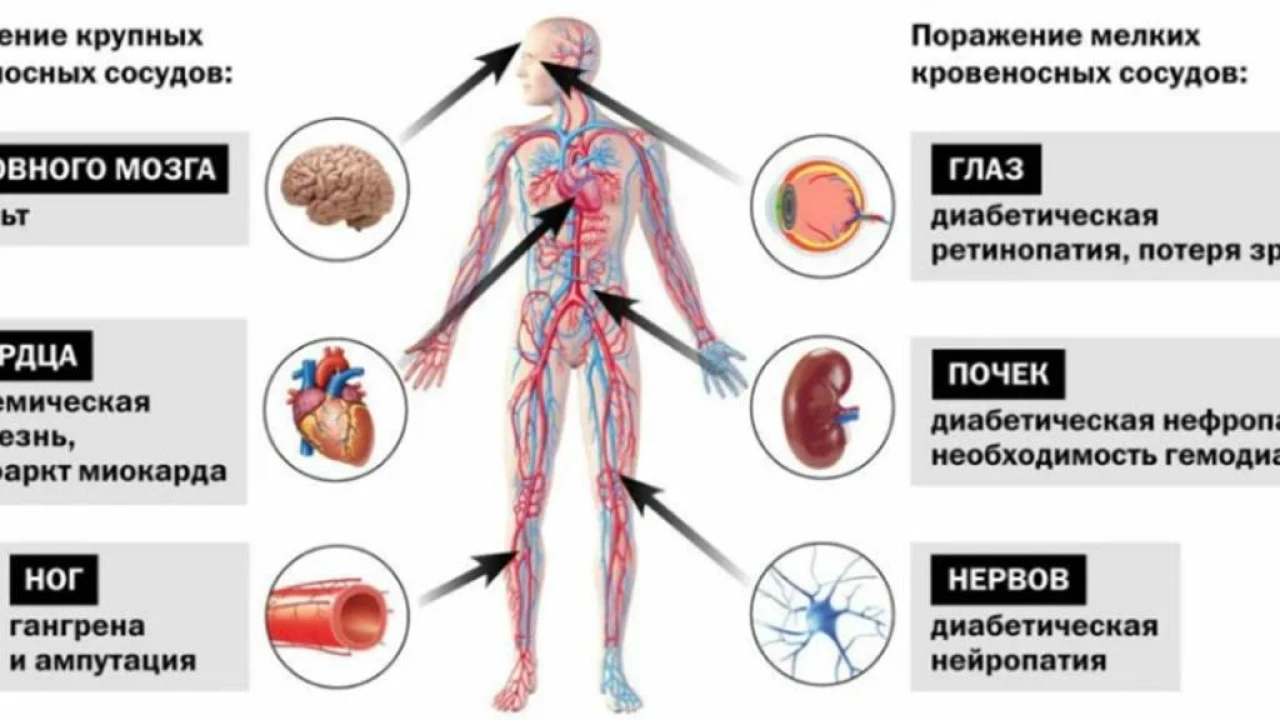 Оценка прогностической ценности структурной вариабельности генома для развития ишемической болезни сердца при сахарном диабете II типа у казахов 