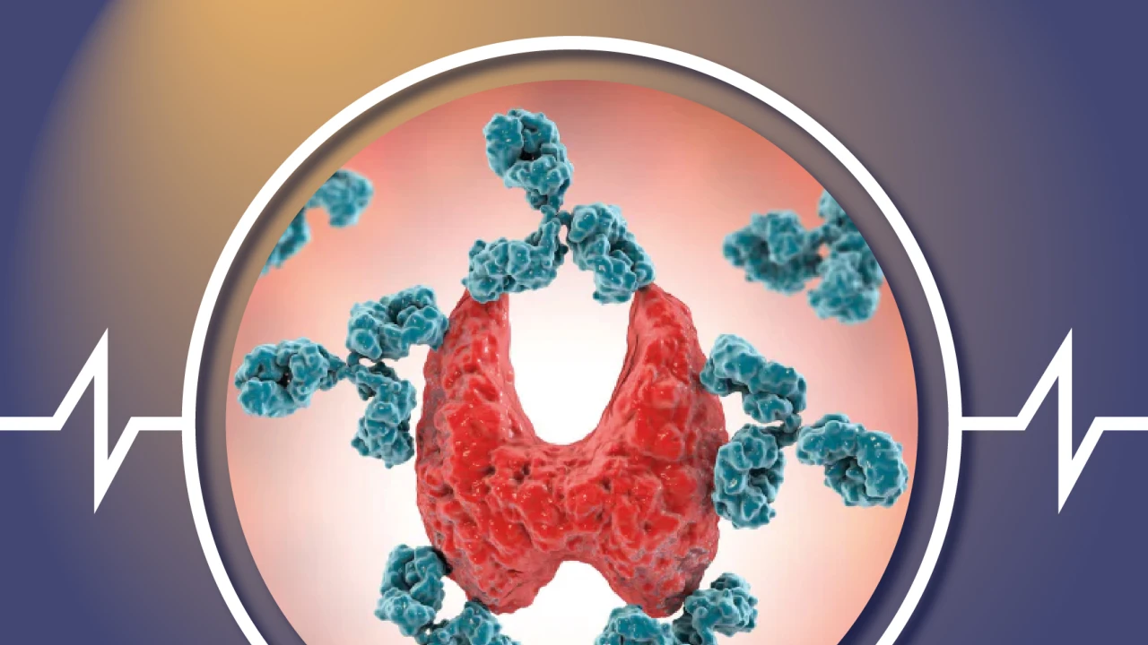 The Center for Autoimmune Diseases 