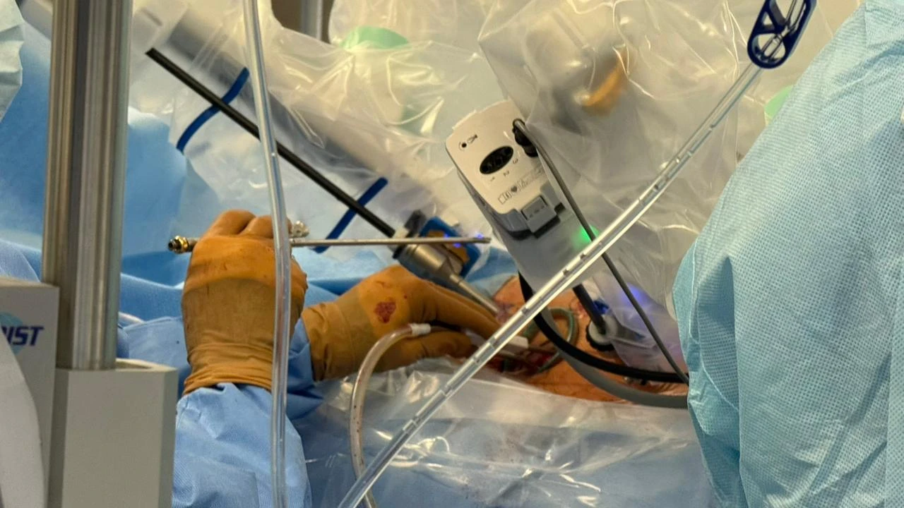 First Robotic Heart Surgery Performed in Kazakhstan 