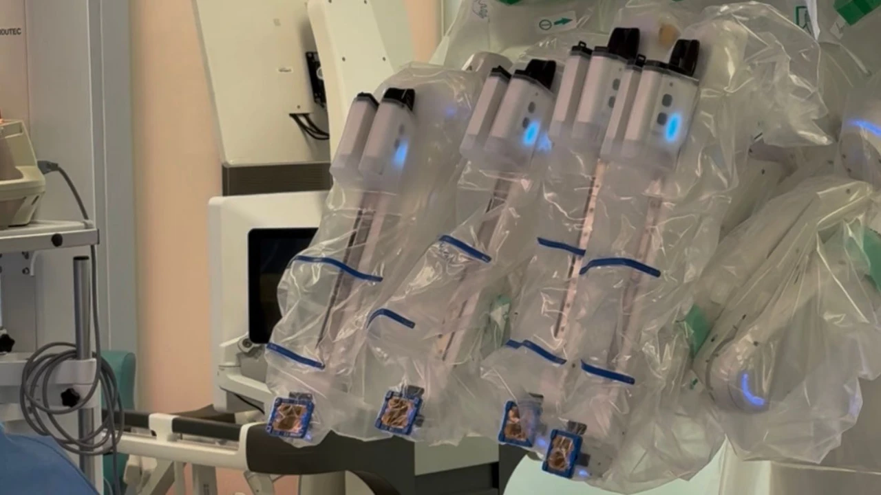 First Robotic Heart Surgery Performed in Kazakhstan 