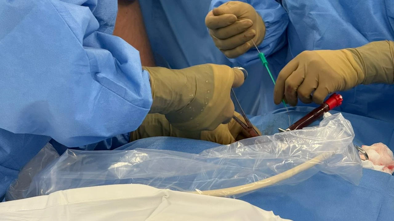 First Robotic Heart Surgery Performed in Kazakhstan 