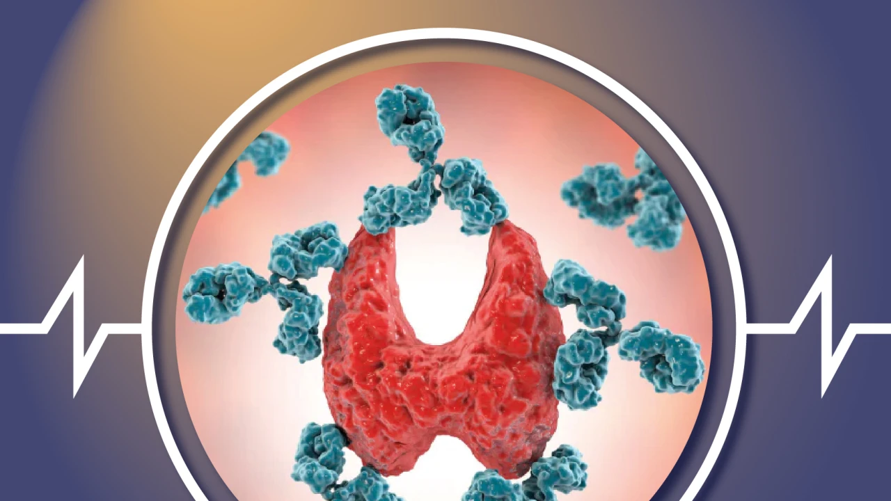 The Center for Autoimmune Diseases 