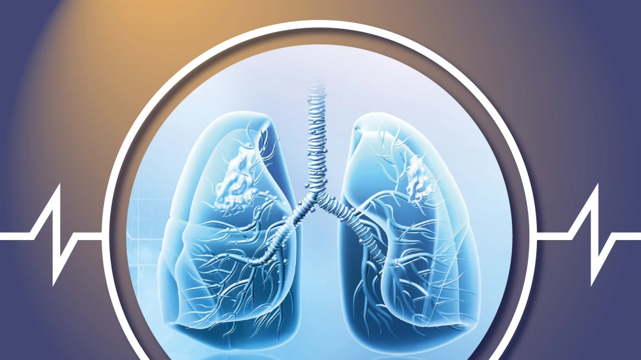 Респираторлық медицина орталығы 